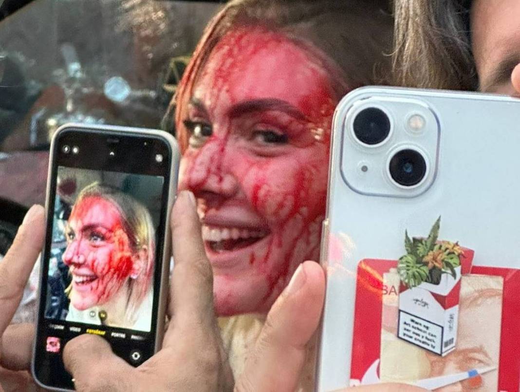 Bergüzar Korel'in kanlı paylaşımı takipçilerini korkuttu! Neden paylaştığı daha sonra ortaya çıktı 2